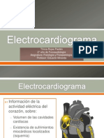 Electrocardiogram A