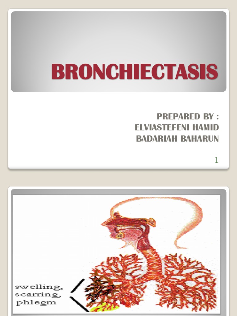 Bronchiectasis Lung Heart Failure