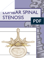 Lumbar Stenosis 2006