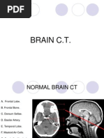 Brain CT