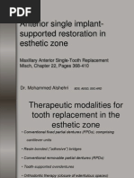 anterior single implant supported restoration in esthetic zone.ppt