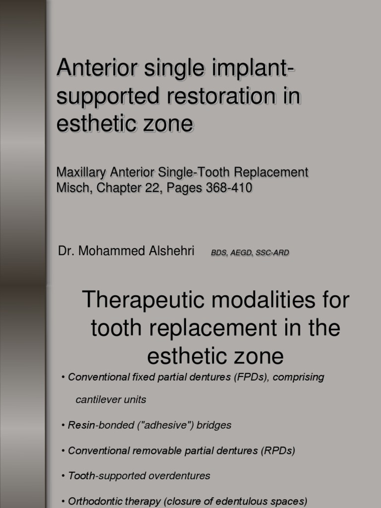 Anterior Implant Restoration in Esthetic Zone | PDF | Dental Implant ...