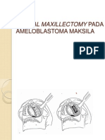 Partial Maxillectomy Pada Ameloblastoma Maksila