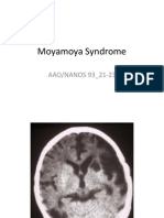 Moyamoya Syndrome PowerPoint