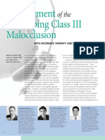Management of the Developing Class III Malocclusion with Face Mask Therapy and Palatal Expansion