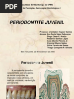 PERIODONTITE JUVENIL