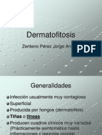 Dermatofitosis 1220744040432127 9