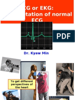 Interpretation of Normal ECG *medical