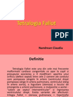 Nandrean Claudiu - Tetralogia Fallot