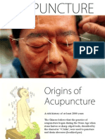Acupuncture (Presentation) by Zheng Jiayin