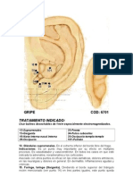 Gripe Auriculoterapia