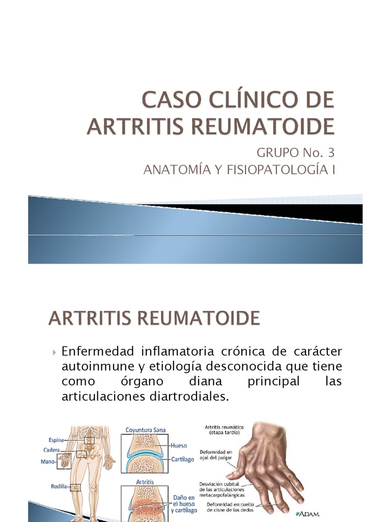 Caso Clinico Artritis Reumatoide Presentacion PDF Inflamación Citocina