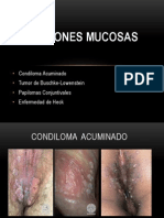 Lesiones Mucosas