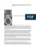 A Subdural Hematoma