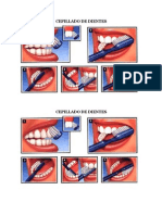 Cepillado de Dientes