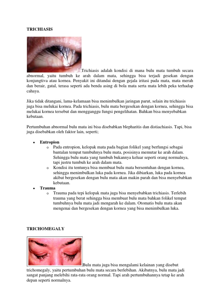 TRICHIASIS | PDF