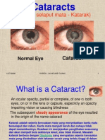 Catarac