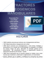 Distractores Osteogenicos Mandibulares