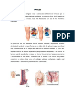 VARICES Resumen