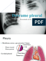 Derrame Pleural