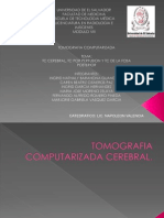 Tc Cerebral Perfusion y Fosa Posterior