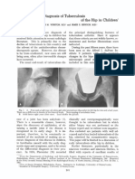 Early Diagnosis of TB