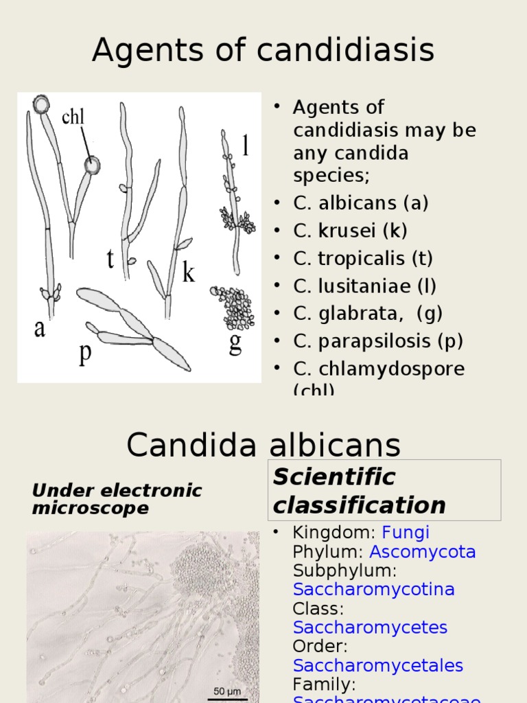 Candidiasis: Fungal Infection Overview | PDF | Candidiasis | Candida ...