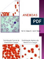 Anemia - B12