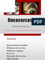 Michael Lopez. Oncocercosis