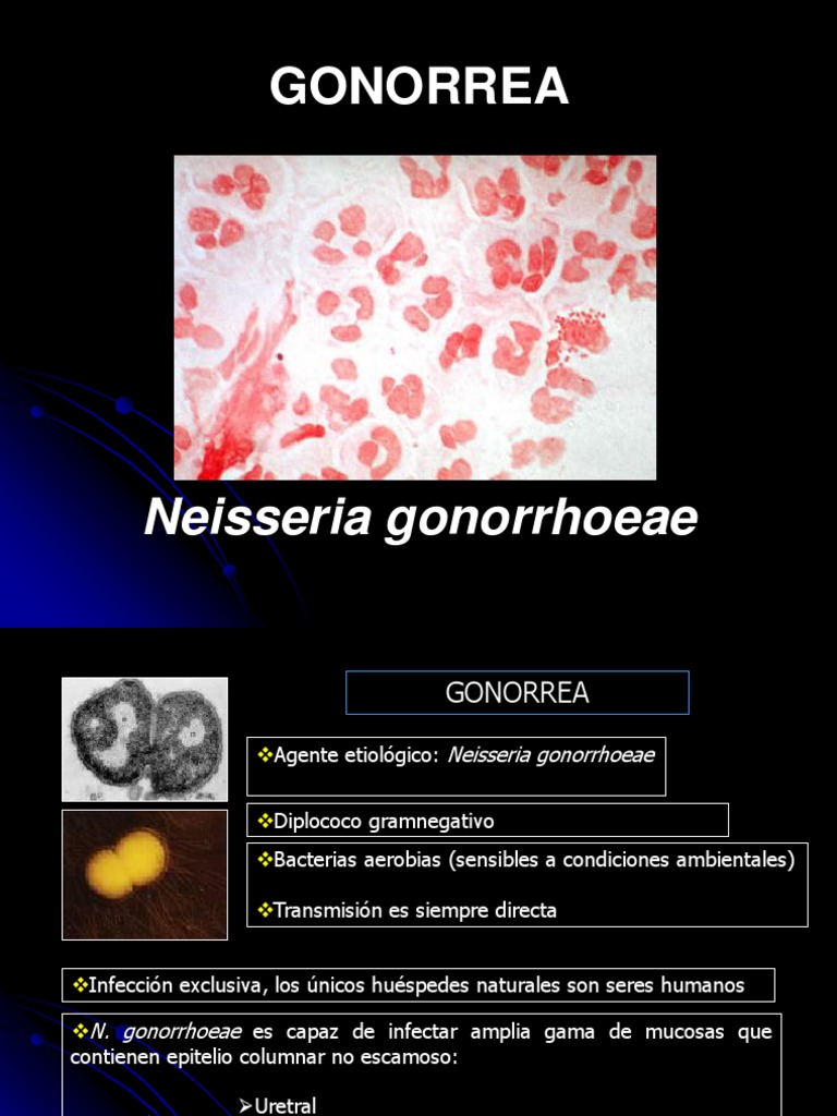 Gonorrea.y Sifilis. Reproducción humana Epidemiología