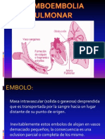 Tromboembolia Pulmonar