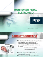 Monitoreo Fetal Electronico