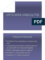 Urticaria.vasculitis