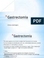 Gastrectomia