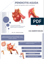 Apendicitis Aguda