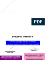 Leucemia