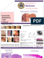 Herpes-Zóster