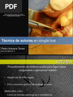 sutura en cirugia oral.ppt