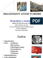 Malignant Liver Tumors Undergrad 6th Year Students Sharaan
