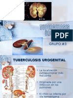 Tuberculosis - Urogenital - Umss - Group 3