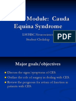 Cauda Equina Syndrome: Signs, Symptoms, and Surgical Timing