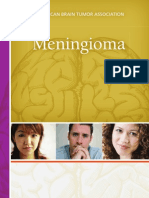 Meningioma