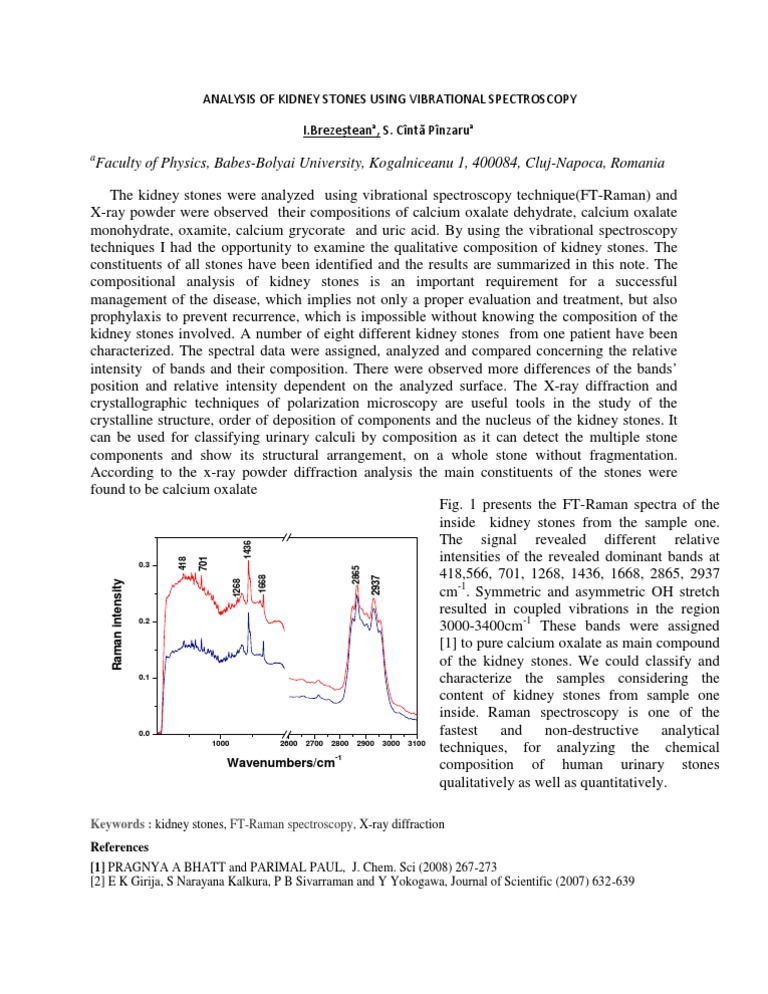 Analysis of Kidney Stones Using Vibrational Spectros PDF