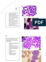 ALL dan AML Diagnosis Berdasarkan Preparat Darah