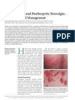 Herpes Zoster and Postherpetic Neuralgia: Prevention and Management