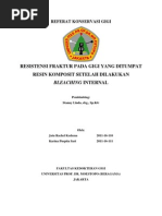 Download Resistensi Fraktur Gigi Yg Ditumpat Komposit Setelah Bleaching Internal 2 by Karina Puspita SN138844522 doc pdf