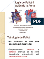 Tetralogía de Fallot & Coartación de La Aorta