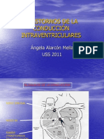 Trastornos de La Conduccion Intraventricular