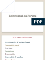 Enfermedad de Perthes