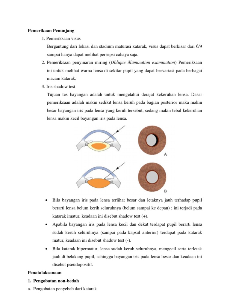 Pemerikaan Penunjang&Terapi Katarak